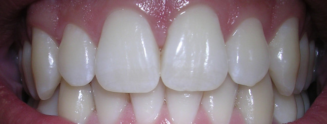 Herbs for teeth and gums?